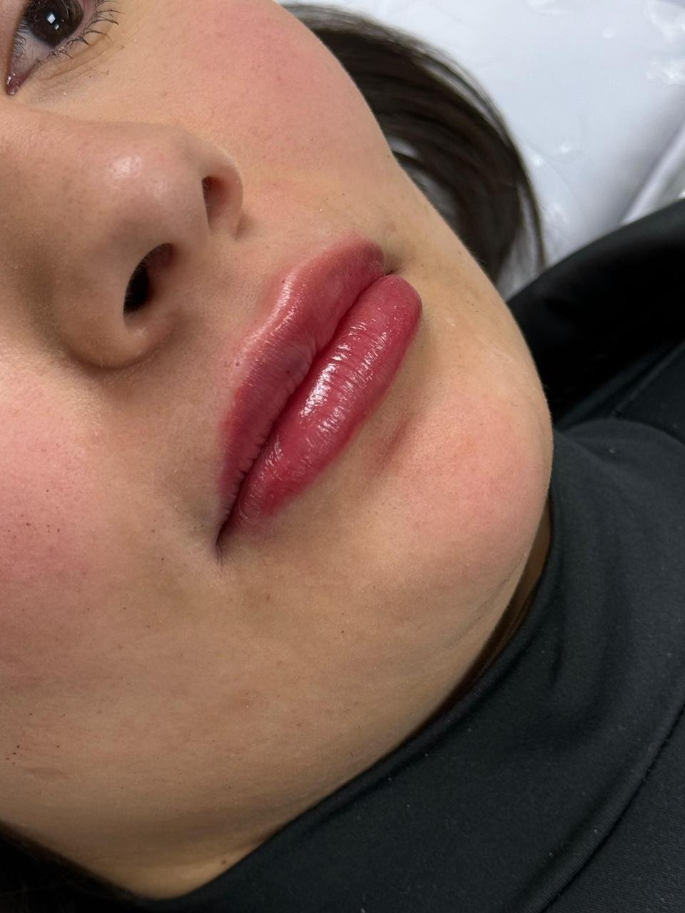 Tratamento facial de rejuvenescimento na clínica AURIÊ em Curitiba
